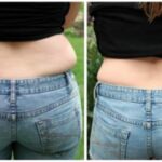 What causes muffin top stomach?