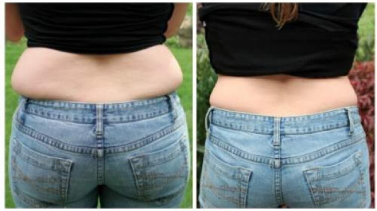 What causes muffin top stomach?