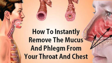 What causes thick mucus at back of throat?