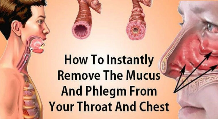 What causes thick mucus at back of throat?