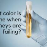 What color is urine when your kidneys are failing?