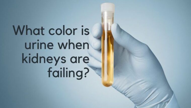 What color is urine when your kidneys are failing?
