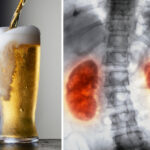 What does beer do to inflammation?
