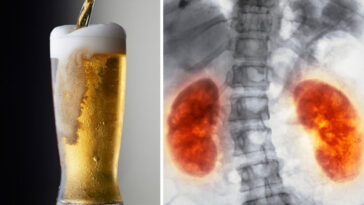 What does beer do to inflammation?