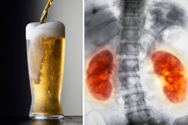 What does beer do to inflammation?
