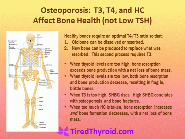 What does hypothyroidism do to bones?