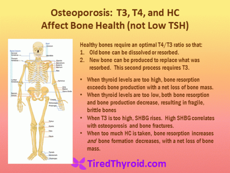 What does hypothyroidism do to bones?