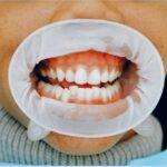 What does it mean when your tooth tingles?