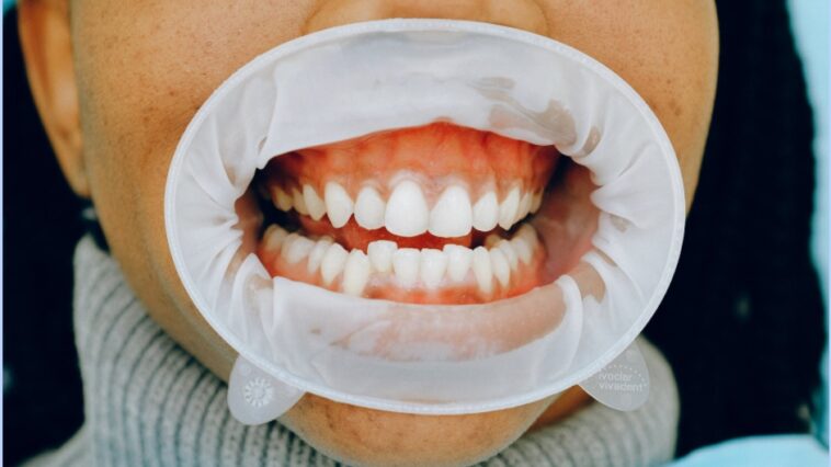 What does it mean when your tooth tingles?