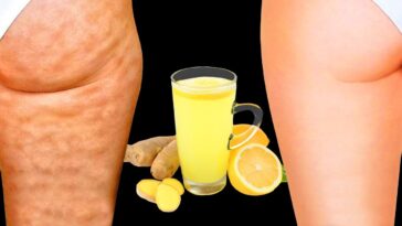 What drinks help cellulite?