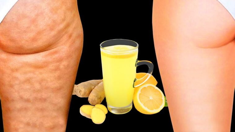 What drinks help cellulite?