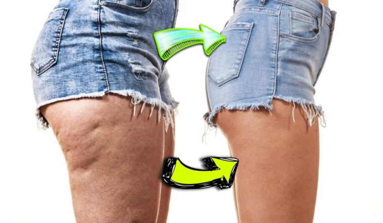 What food make your legs fat?