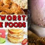 What foods are causing my acne?