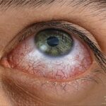 What foods damage your eyes?