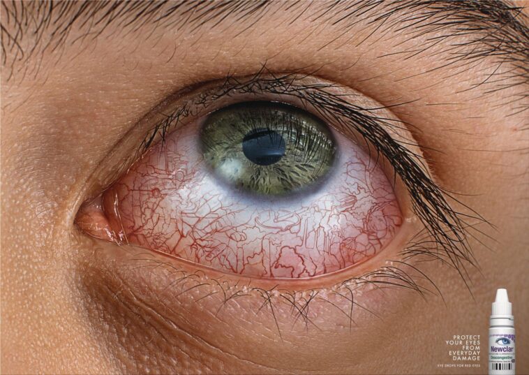 What foods damage your eyes?