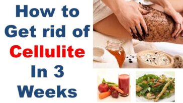 What foods get rid of cellulite fast?