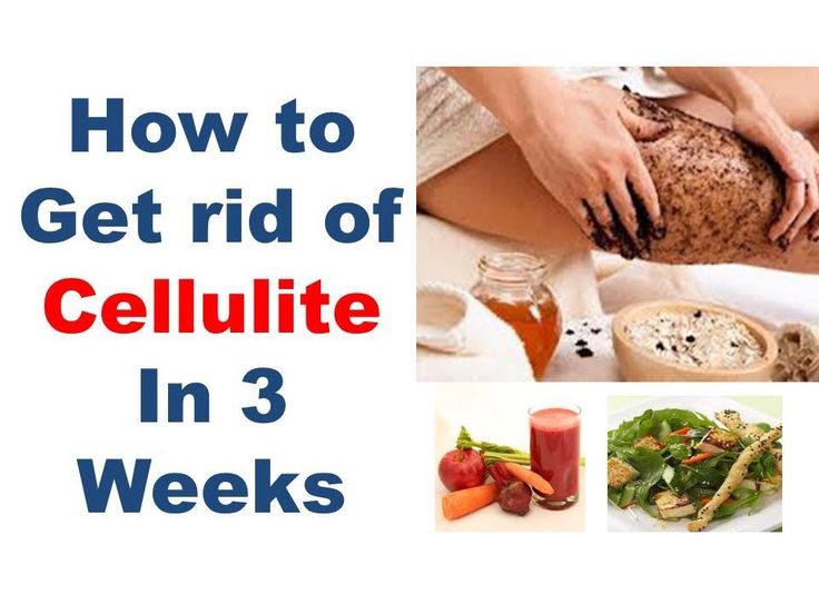 What foods get rid of cellulite fast?