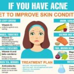 What foods help clear acne?