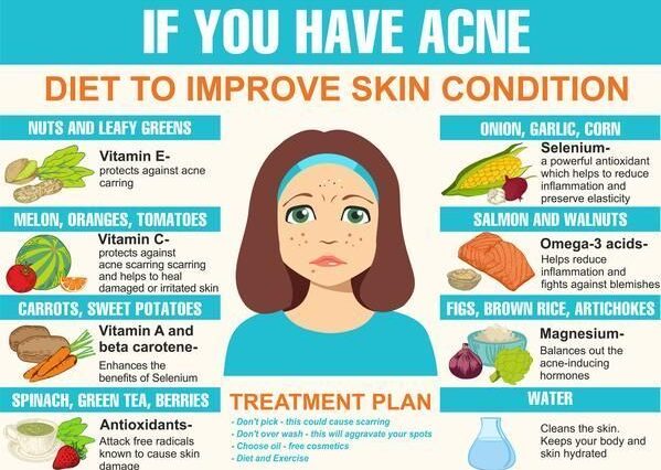 What foods help clear acne?