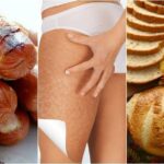 What foods worsen cellulite?