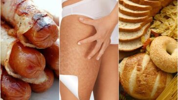 What foods worsen cellulite?