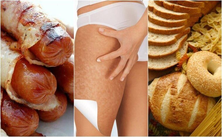 What foods worsen cellulite?