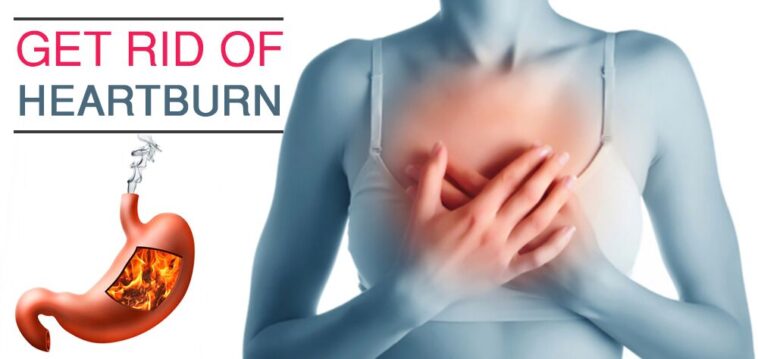 What gets rid of heartburn fast?