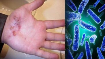 What happens to your feet if you dont wash them?