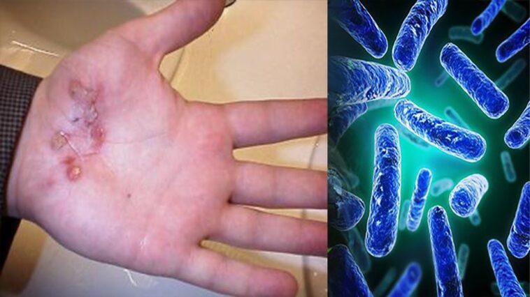 What happens to your feet if you dont wash them?