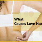What hormone causes Lovehandles?