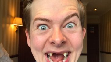 What is a person without teeth called?