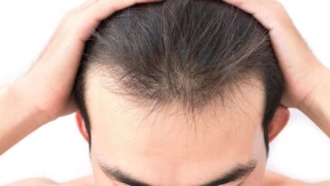 What is causing my hair to thin?