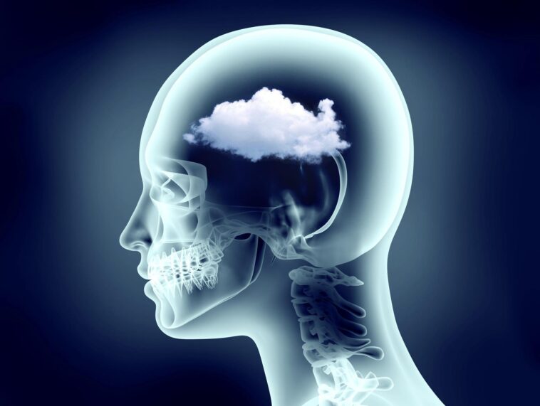 What is fuzzy brain?