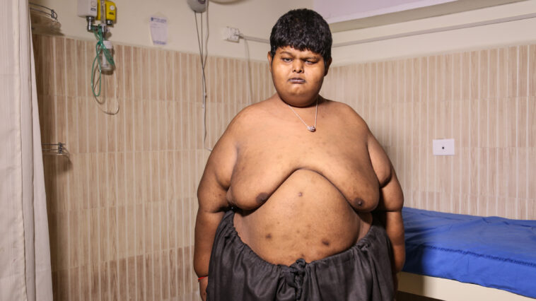 What is underweight for a 15 year old?