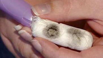 What kills mold in the body?