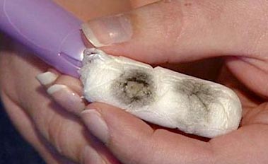 What kills mold in the body?