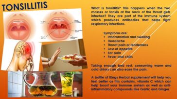 What kills tonsillitis fast?