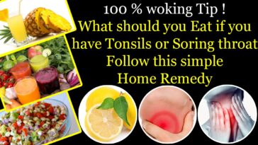 What should you not eat when you have tonsillitis?