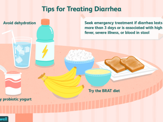 What stops diarrhea fast?