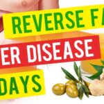 What supplement is best for fatty liver?