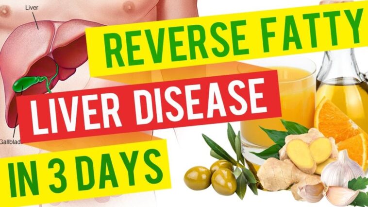 What supplement is best for fatty liver?