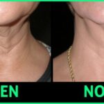 What tightens skin naturally?