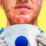 What to do if you have a reaction to a face mask?