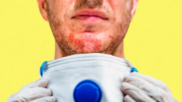 What to do if you have a reaction to a face mask?