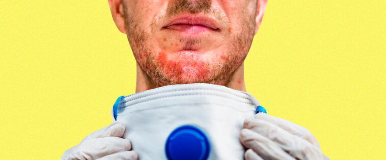 What to do if you have a reaction to a face mask?