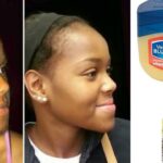 What vitamin is good for face?