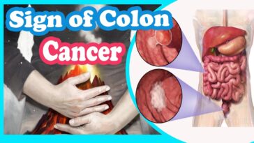 What was your first colon cancer symptom?