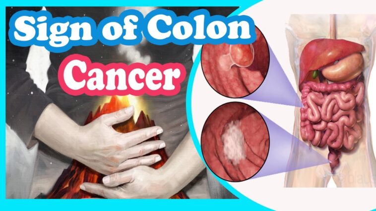What was your first colon cancer symptom?