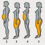Where is the first place you lose weight on your body?