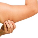Why are my upper arms flabby?